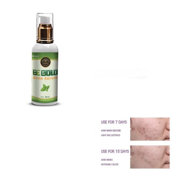 Be Bold Acne Treatment Serum, Cream Herbal Supports Relief of Spots, Blemishes, Whitehead, Blackhead, Pimples Acne Pro active Scar Skincare - Image 2