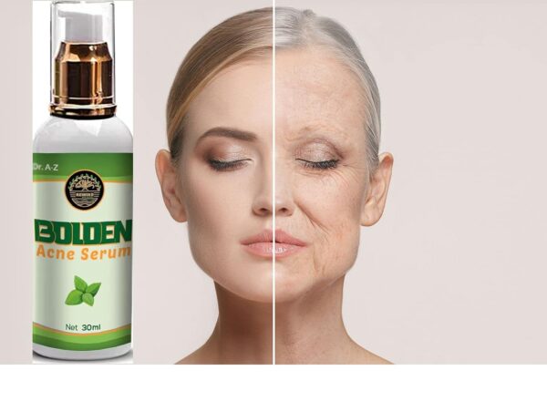 Be Bold Acne Treatment Serum, Cream Herbal Supports Relief of Spots, Blemishes, Whitehead, Blackhead, Pimples Acne Pro active Scar Skincare - Image 9